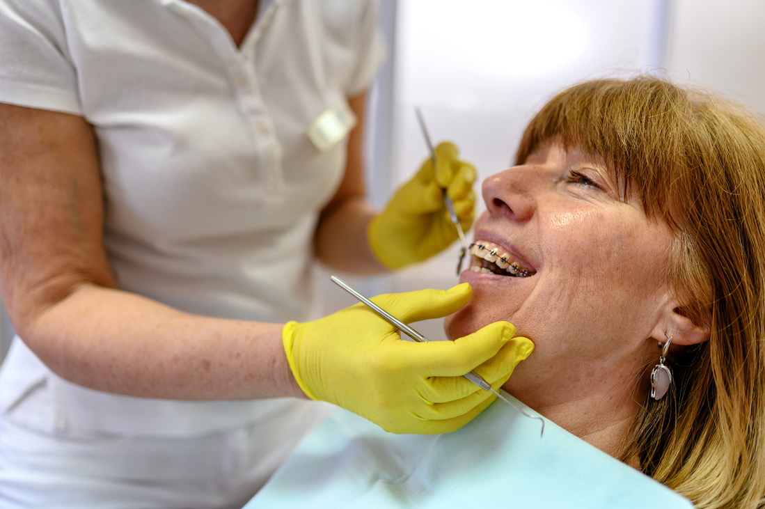 fogorvos fogszabályozó felnőtt fogszabályozás